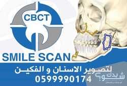 Smile scan لتصوير الاسنان والفكين (CBCT)